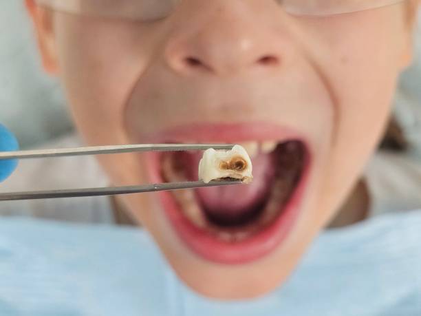 Best Urgent Care for Lost Fillings or Crowns in Waikele, HI